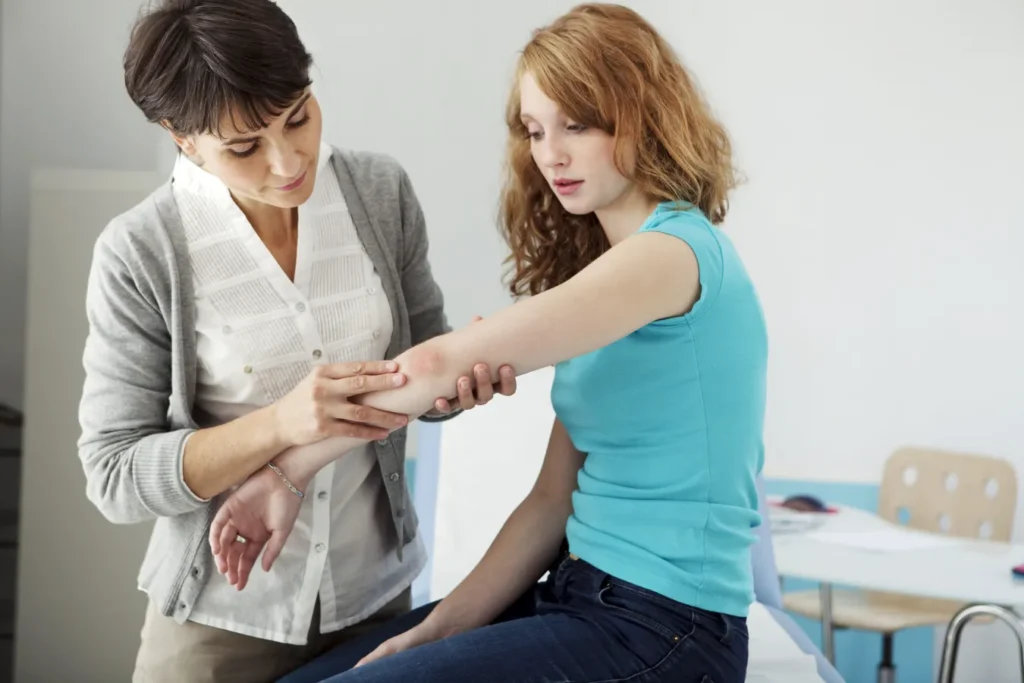 Psoriasis