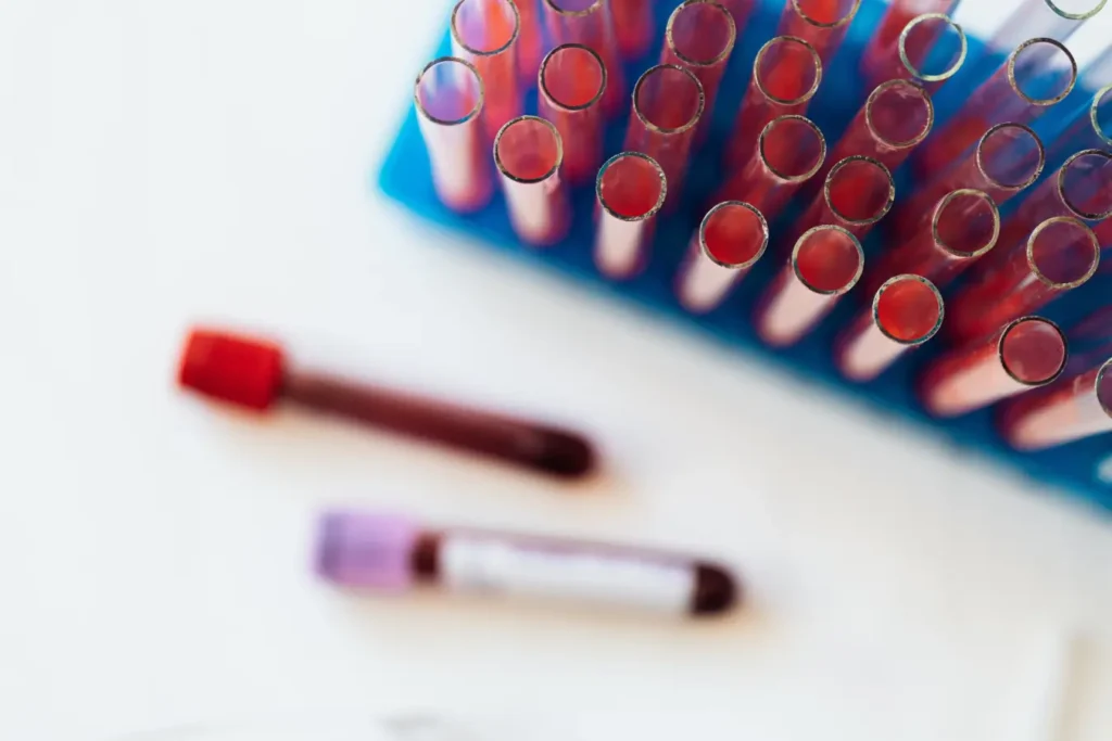 triglycerides