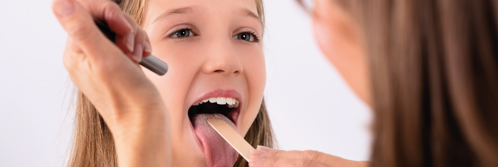 Canker sores on the tongue