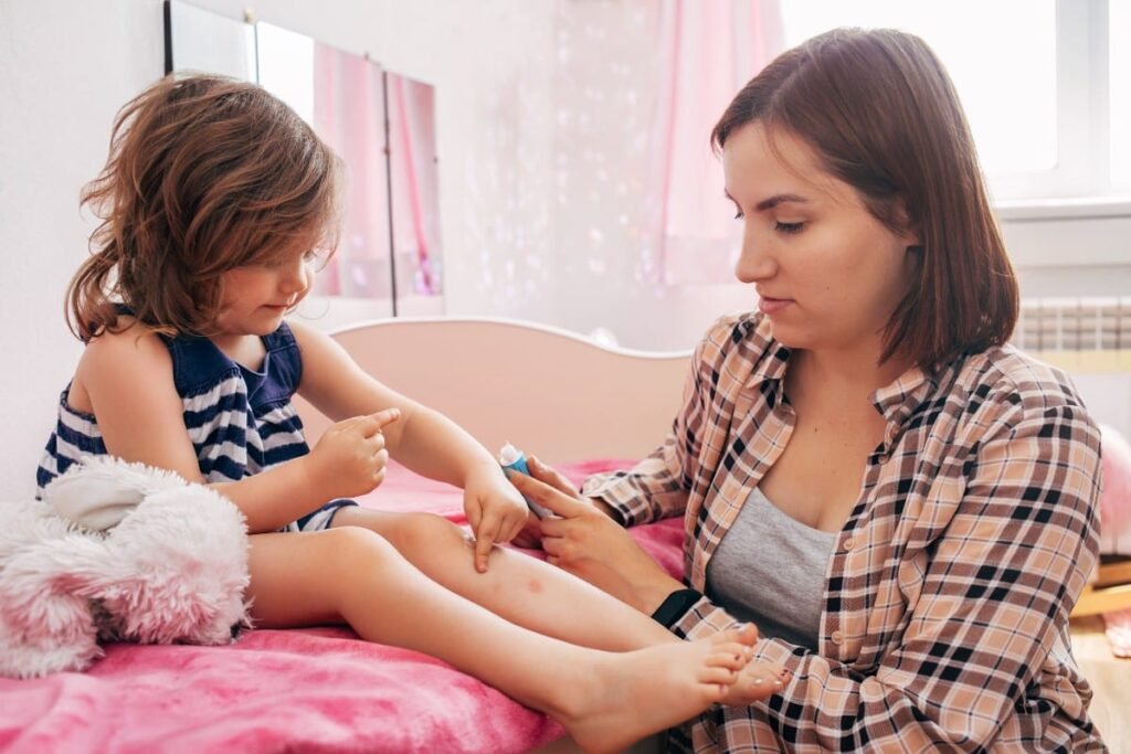 Impetigo in children