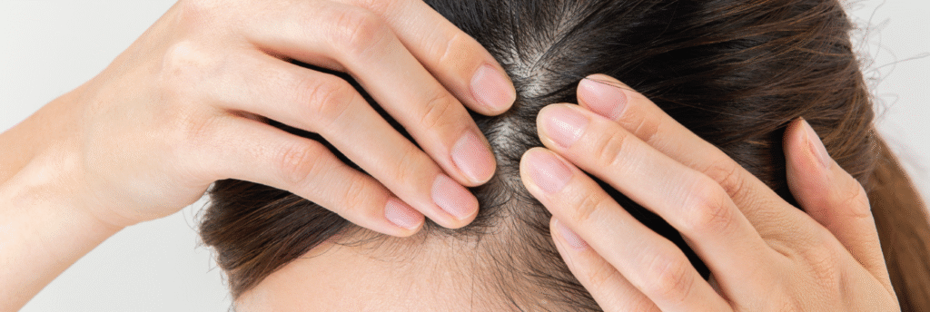 scalp