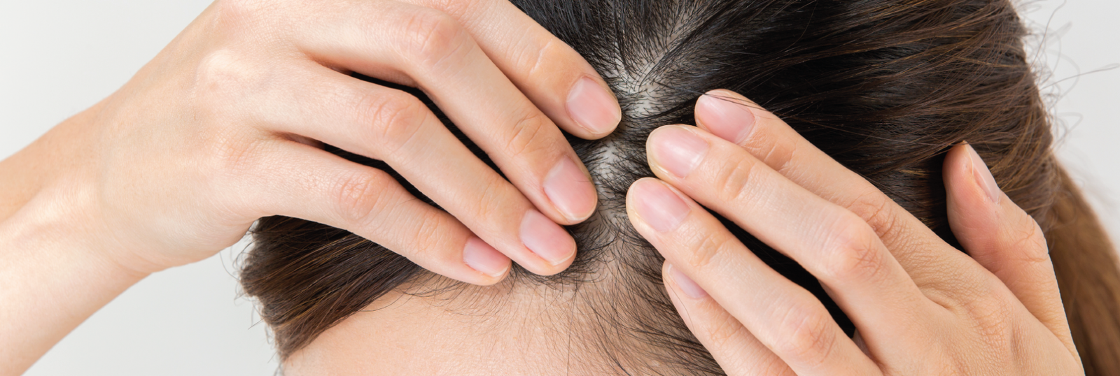 scalp