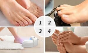 Hewelth BioClear Nail Fungus Device