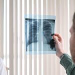 What is Pulmonary TB and How is it Treated?