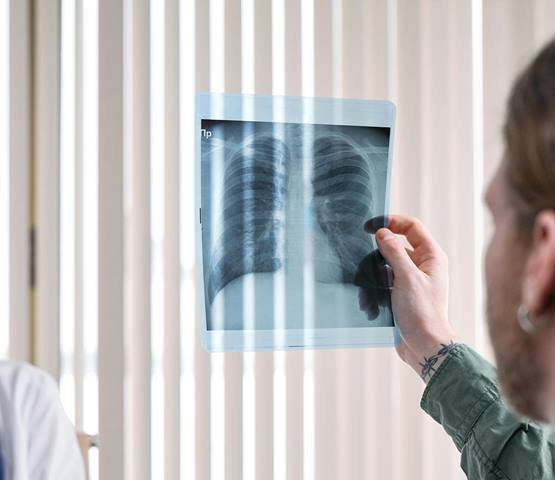 What is Pulmonary TB and How is it Treated?