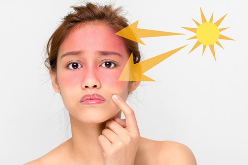 Sunburned Skin