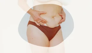 Swollen Stomach: What to Do? Causes, Treatments, and Practical Advice