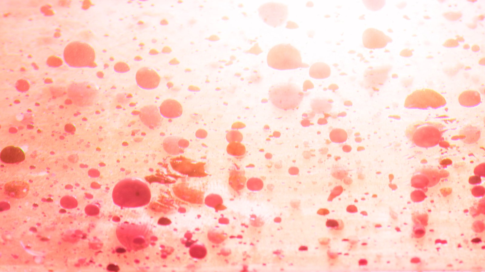 White Blood Cells