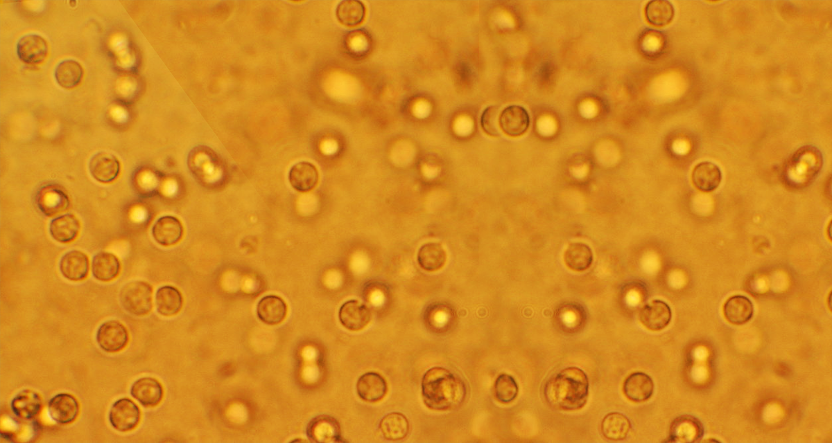 urinary tract