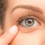 Home Treatment To Relieve Dark Circles