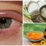 Fight Eye Infections With These Remedies