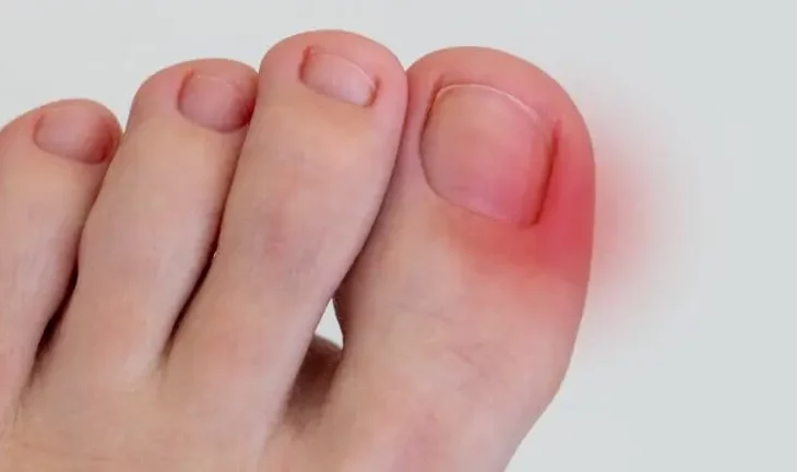 toenails